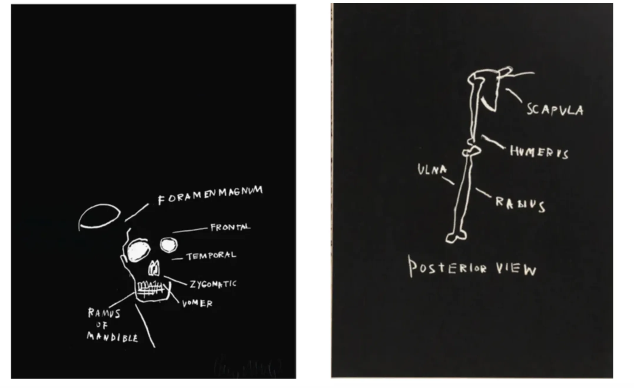 Jean-Michel Basquiat: Signed Set of 2 works Rasmus of Mandible and Posterior View  (Anatomy Suite), 1982